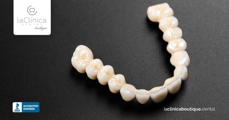 Modelo de dientes artificiales de cerámica, representando tratamientos de implantes dentales en La Clínica Dental Guadalajara.